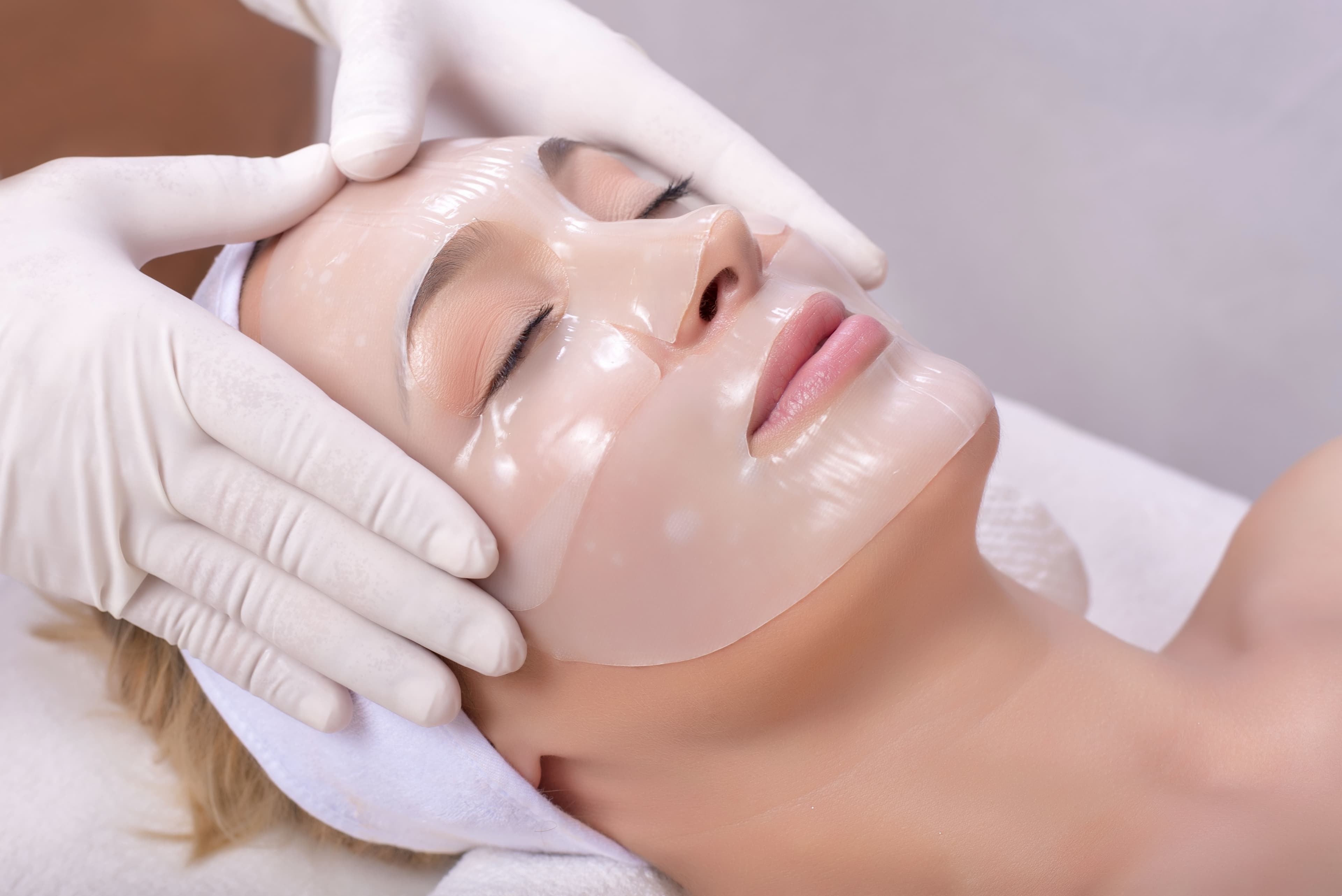 Chemical Peel