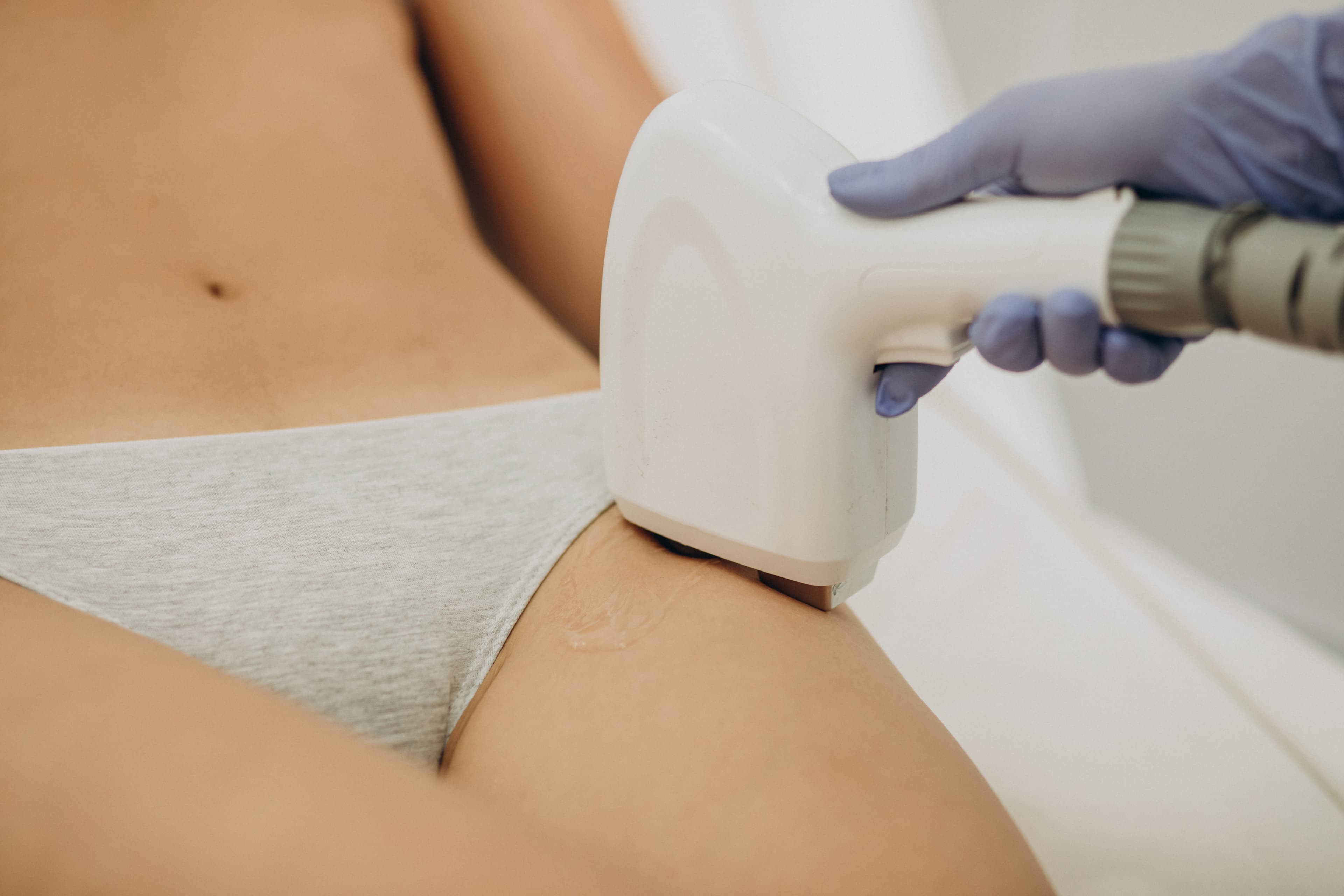 Bikini laser hair reduction treatment