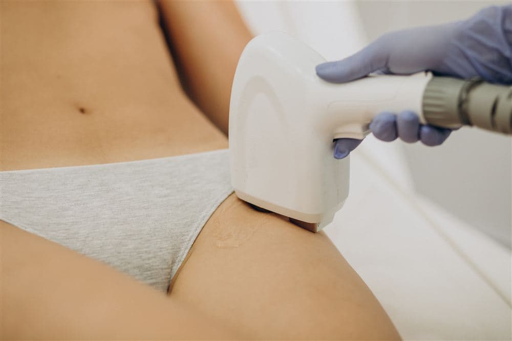 Bikini laser hair reduction treatment
