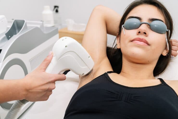 Underarms laser hair reduction treatment